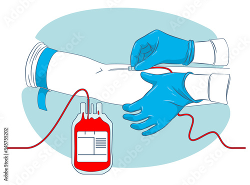 Donor blood collection process, a nurse’s hands are preparing to install a donor blood collection needle on a donor’s arm