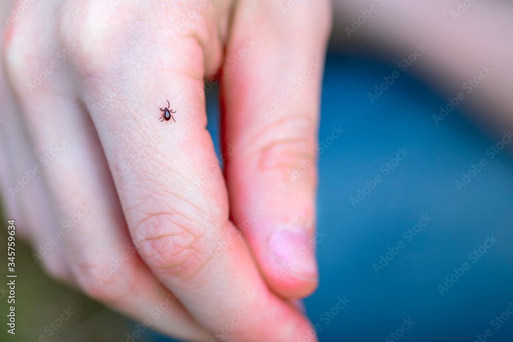 Mite on child's hand. Dangerous tick on the skin crawls along the arm Mite on child's hand. Dangerous tick on the skin crawls along the arm