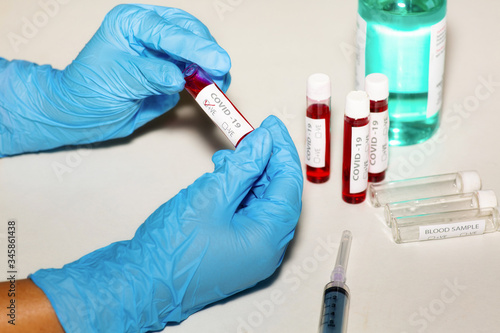 Fotografi Medical examiner in a laboratory holds a blood sample of a positive corona virus