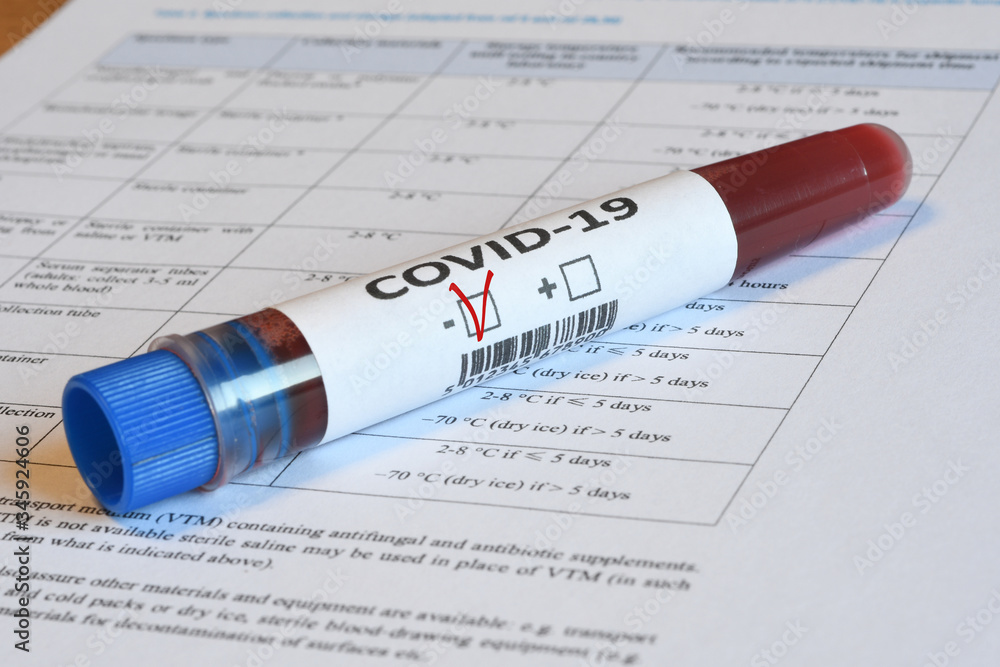 Detail of blood test samples for presence of coronavirus (COVID-19) tube containing a negative blood sample. Detail of blood test samples for presence of coronavirus (COVID-19) tube containing a negative blood sample.
