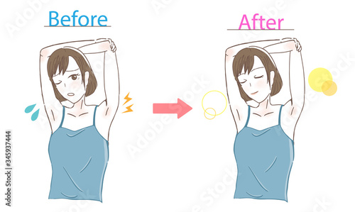 肩こりを気にする女性　ビフォーアフター