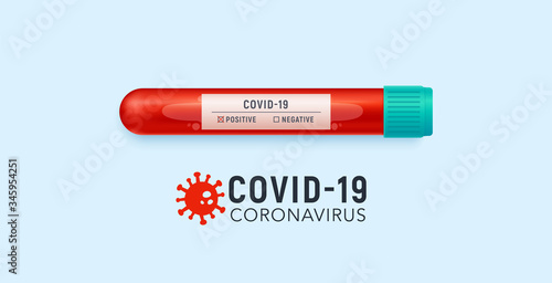 Coronavirus blood test. Blood tube for testing in laboratory on coronavirus COVID-19