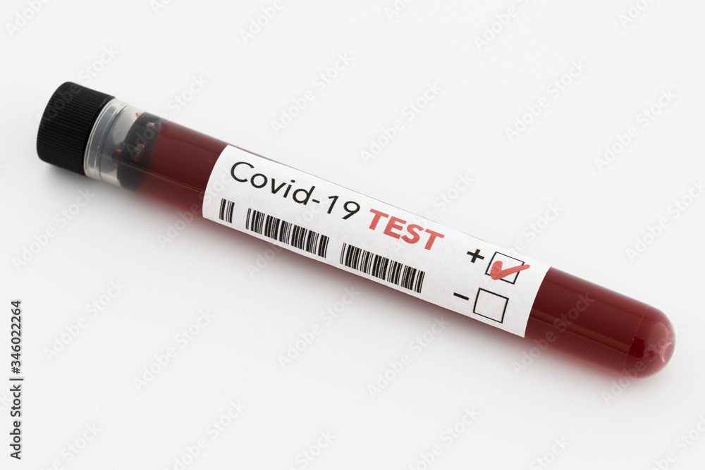 positive blood test result positive blood test result
