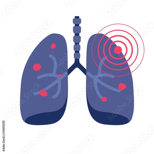 Lungs cancer illness or lung pneumonia and bronchitis tuberculosis pulmonary disease vector flat icon illustration, concept of medicine or medical respiration infection of organ sign isolated