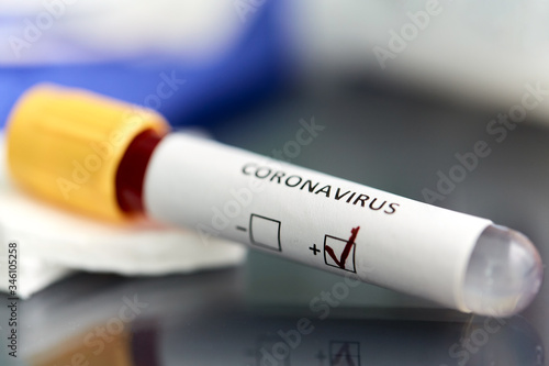 medicine, healthcare and pandemic concept - close up of beaker with positive coronavirus blood test on table at laboratory