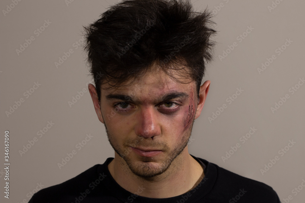 Fototapeta premium Defiant injured young man looking at the camera