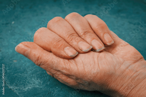Close-up of woman's dirty hand and nails.  Concept unhealthy.