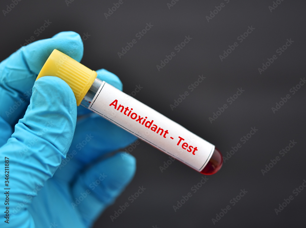 Obraz premium Test tube contain with blood sample for antioxidant test