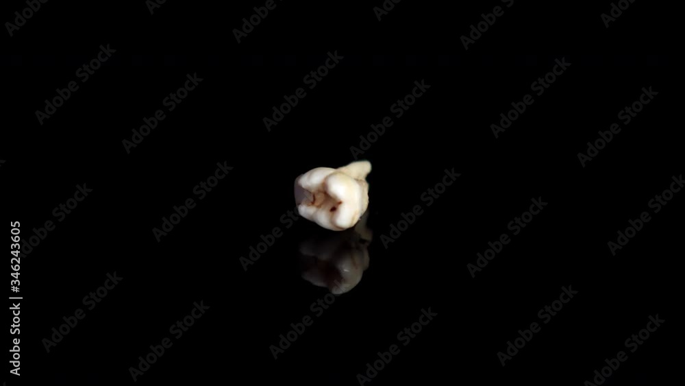 Pulled out baby tooth on a black background. Extracted tooth isolated on black. Closeup Pulled out baby tooth on a black background. Extracted tooth isolated on black. Closeup