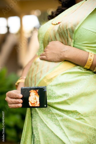 Photography a lady holding a scan photo of her baby