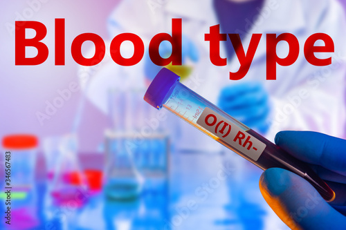 Determination of blood type...