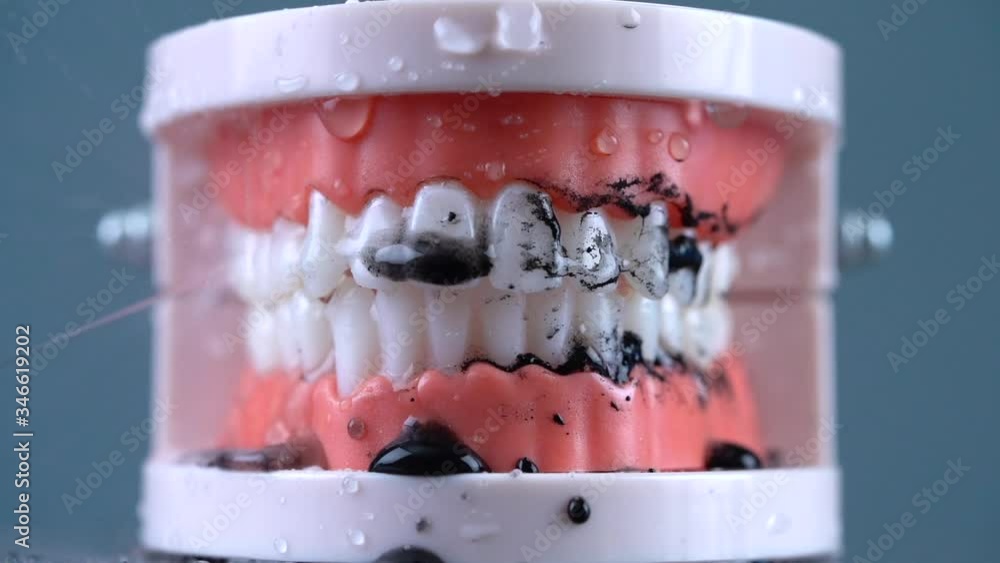 Teeth Cleaning Water Pressure Tooth jaw. Brushing teeth with a dental
