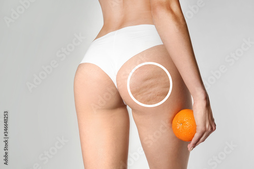 Young woman with orange on light background. Problem of cellulite photo