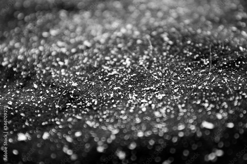 Dandruff on black shirt Dandruff on black shirt