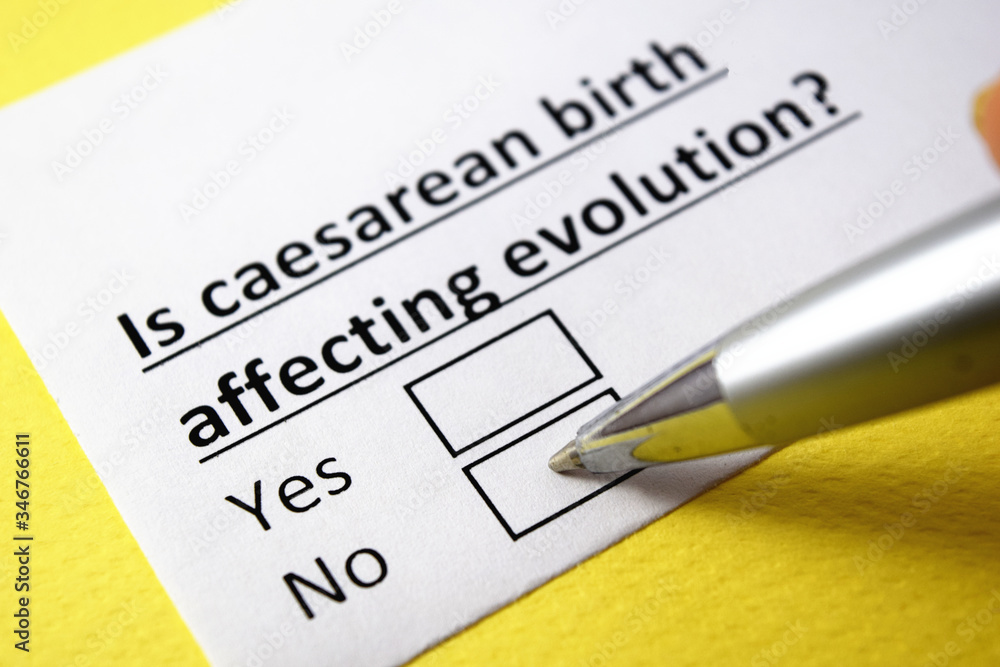 Is caesarean birth affecting evolution? Yes or no? Is caesarean birth affecting evolution? Yes or no?