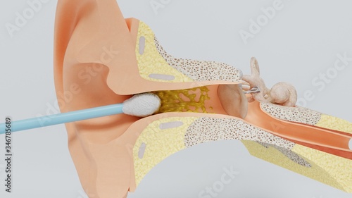 Fotografie 3d render ear cleansing ear stick