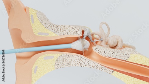 Foto 3d render ear cleansing ear stick