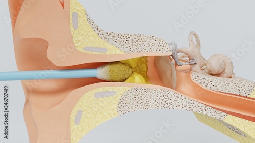 Fotografie 3d render ear cleansing ear stick