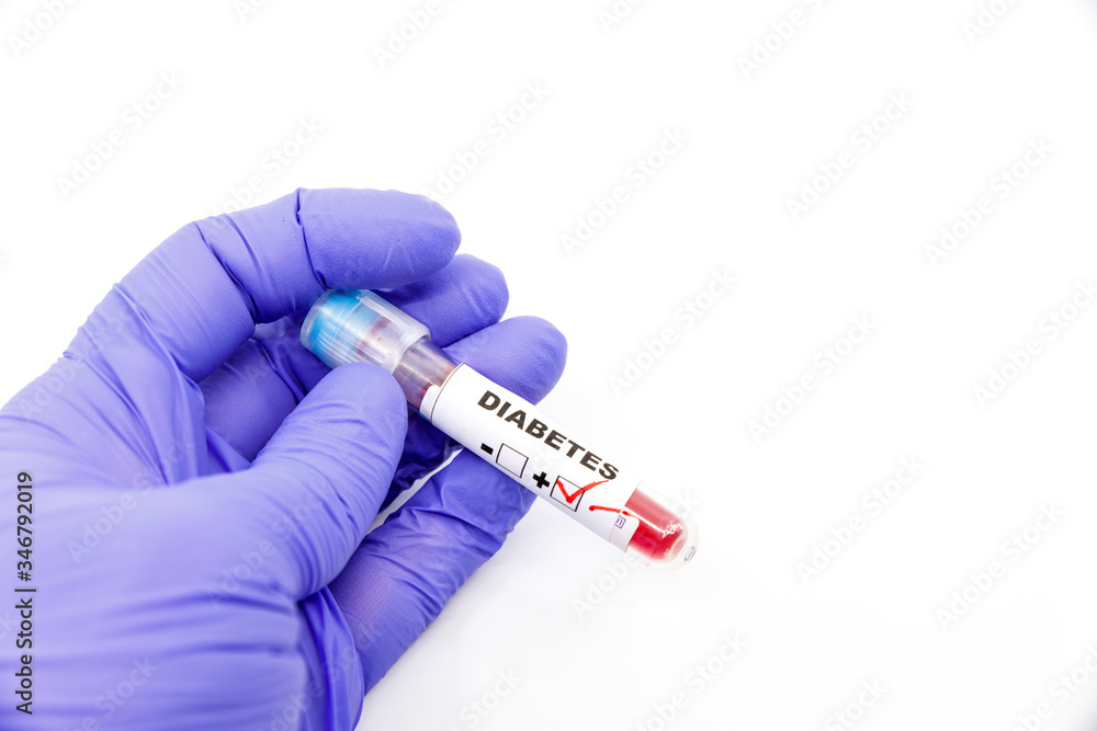 Obraz premium Closeup of microbiologist or medical worker hand with blue surgical gloves marking blood test result as positive for the diabetes. Diabetes Positive concept