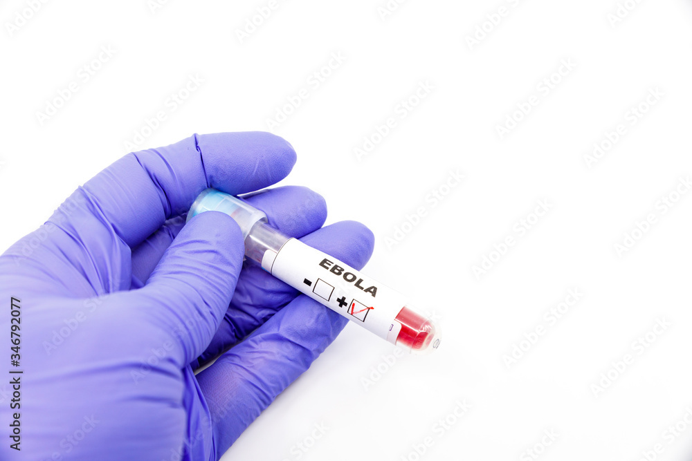 Obraz premium Closeup of microbiologist or medical worker hand with blue surgical gloves marking blood test result as positive for the ebola. Ebola Positive concept
