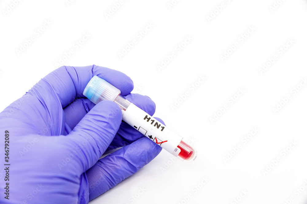 Fototapeta premium Closeup of microbiologist or medical worker hand with blue surgical gloves marking blood test result as positive for the H1N1. H1N1 Positive concept