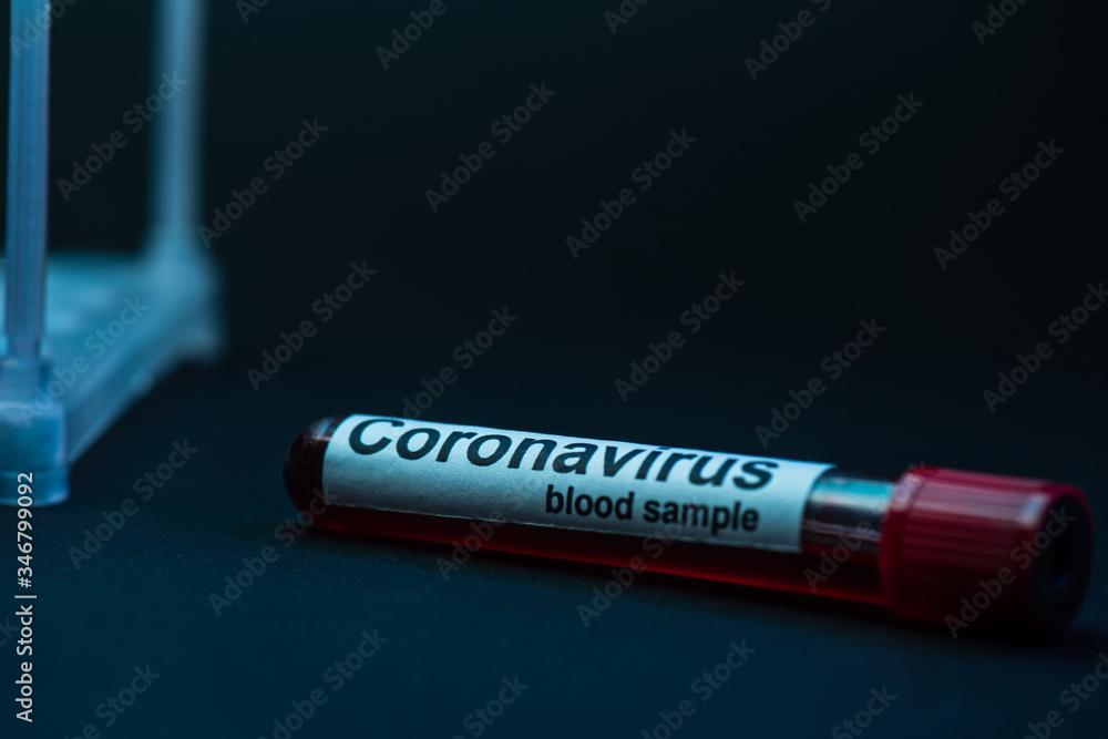 Obraz premium Selective focus of sample tube with coronavirus blood sample on dark
