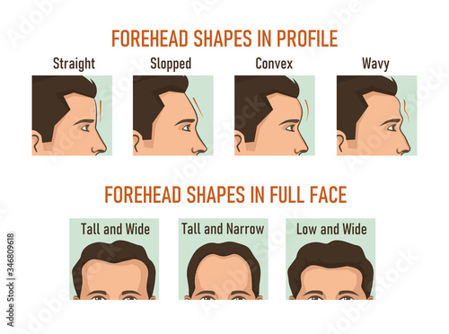 Forehead shapes in profile and full face