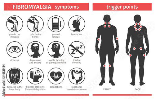 Symptoms and signs of fibromyalgia. Tender points. Infographic. Template for use in medical agitation. Vector illustration, flat icons. photo