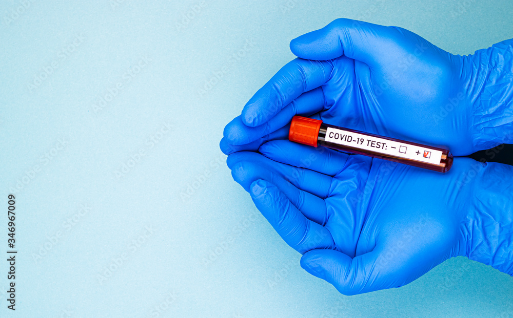 Obraz premium male hands in blue medical gloves hold an ampoule of blood with a positive test for covid-19. passing a test for the presence of coronavirus, space for text