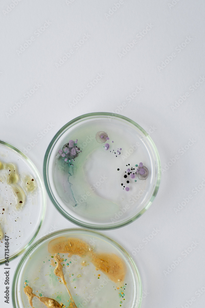Viruses and bacteria in a Petri dish, studying the growth of bacteria on different samples in the laboratory. Viruses and bacteria in a Petri dish, studying the growth of bacteria on different samples in the laboratory.