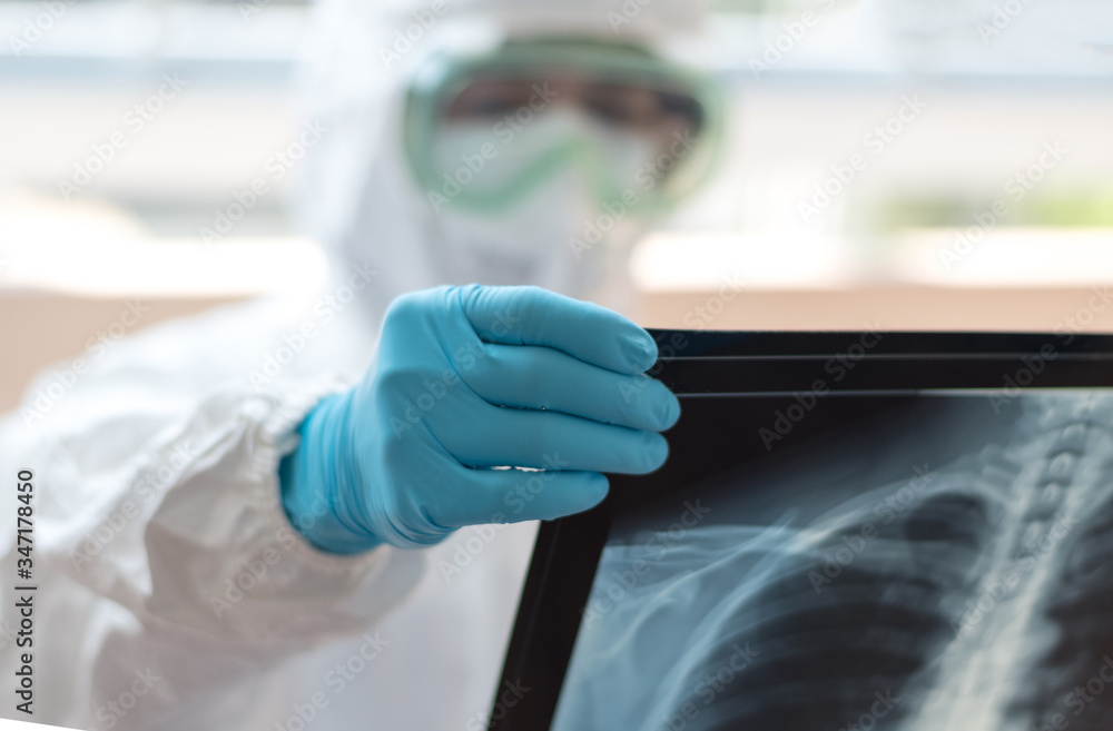 Covid-19 doctor concept. Medical staff in PPE suit hold chest x-ray film of patient in hospital medical healthcare.