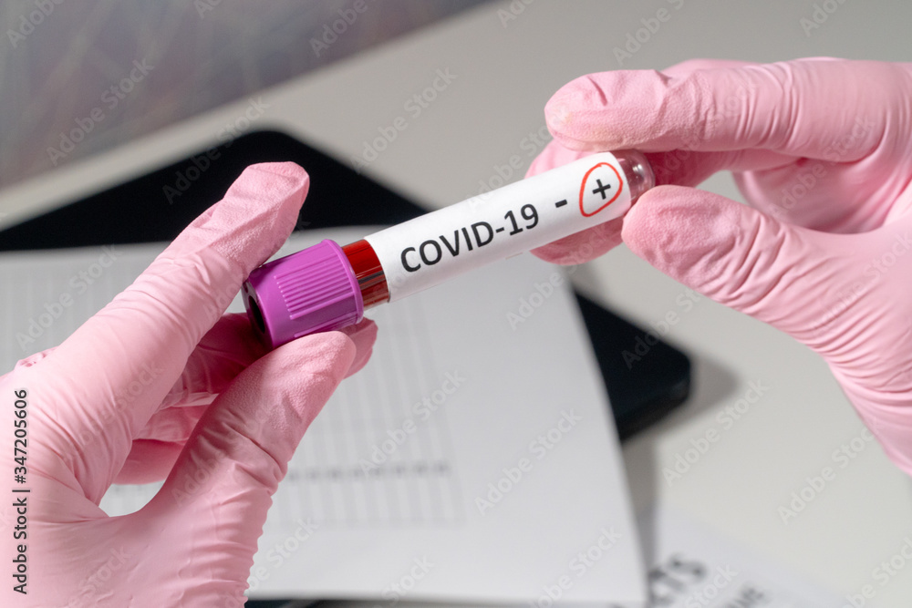 Obraz premium Doctor in pink medical gloves holds test tubes with blood for analysis of virus COVID-19