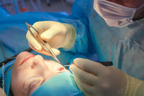 The surgeon makes an incision on the patient eyelid during blepharoplasty surgery. Close up photo