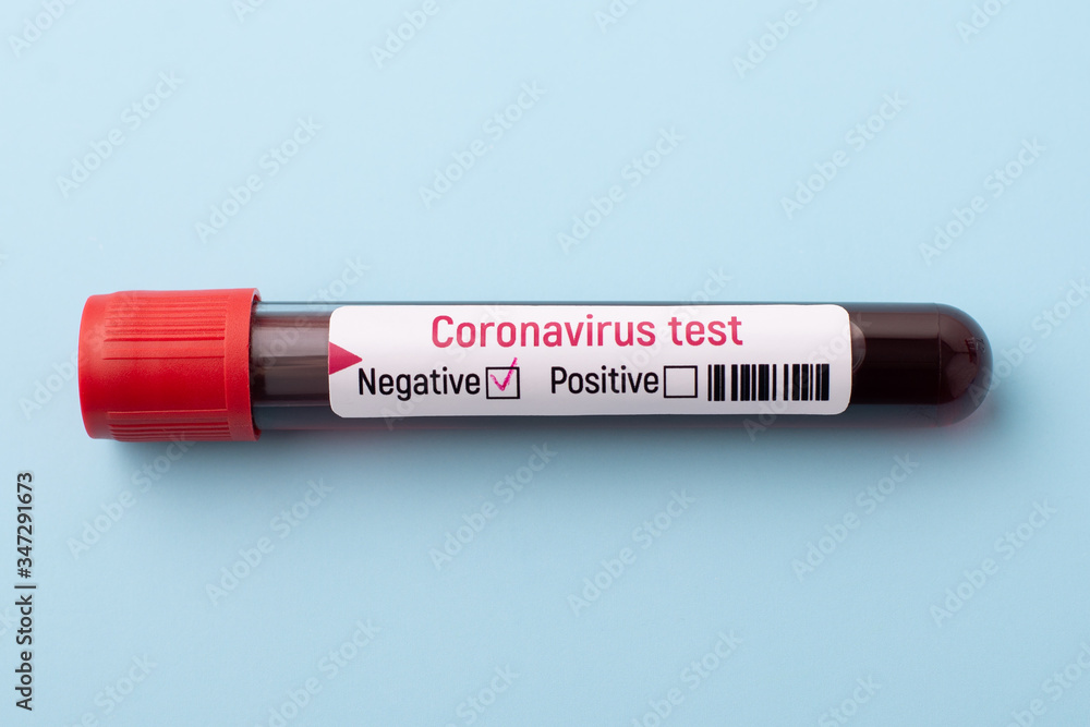Test tube with negative result of coronavirus on blue background. End of coronavirus lockdown Test tube with negative result of coronavirus on blue background. End of coronavirus lockdown