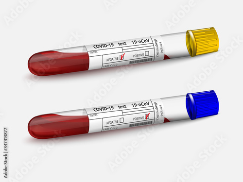 Blood sample in in two glass test tubes. Covid-19 test. Positive and negative results SARS-CoV-2. Isolated on white. Coronavirus analysis. Blood test. Vector illustration.