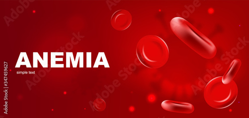 Anemia realistic vector banner template. Red blood cells 3d mock up design. Erythrocyte flow. Hemoglobin low level. Hematology advertisement horizontal printable flyer, brochure with text space