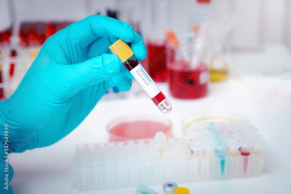 Researchers test blood samples in the laboratory. Researchers are inventing vaccines to treat COVID-19 virus. Researchers test blood samples in the laboratory. Researchers are inventing vaccines to treat COVID-19 virus.