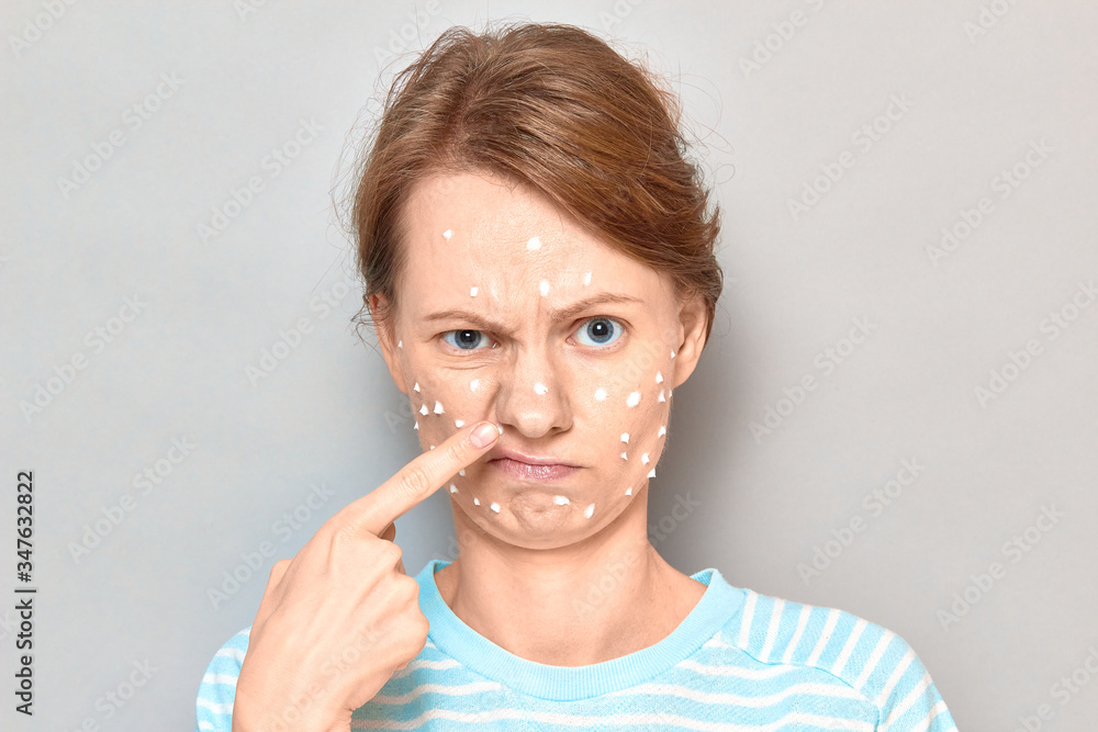 Portrait of dissatisfied girl with white drops of face cream on skin Portrait of dissatisfied girl with white drops of face cream on skin