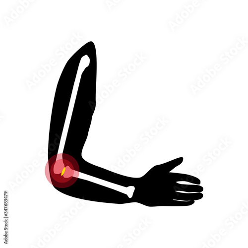 Hand elbow joints health and care vector illustration