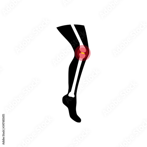 Leg joints joints health and care vector illustration