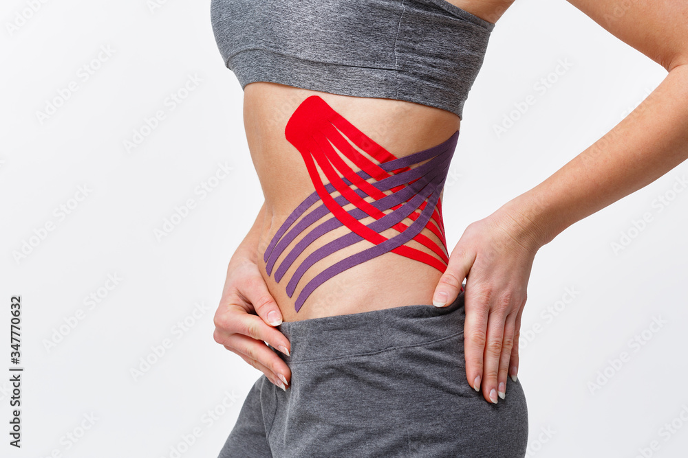 Weight loss concept. Kinesiology taping.Anti-cellulite procedure for slim  belly.Close up view of kinesiology tape on patient tummy.Fat lose,  cellulite removal, sport physical therapy,recovery concept. Stock Photo |  Adobe Stock