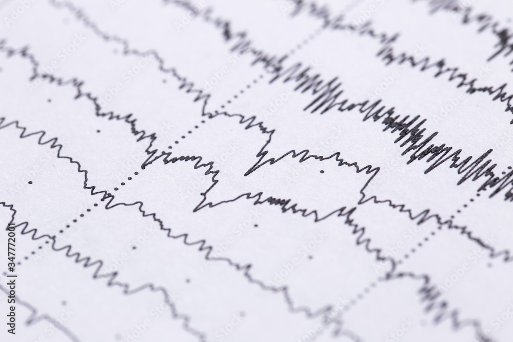 Cardiogram on a sheet of paper close-up. Texture of pulsed waves.