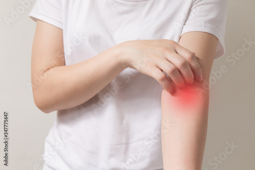 Scratching arm, Itching of skin diseases with young female and have red around the Itching area. Concept Healthcare.