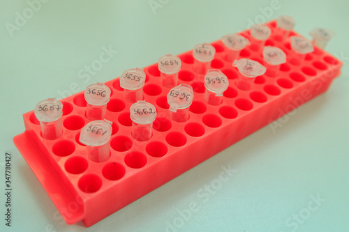 Diagnosis of coronavirus by PCR method in Ukraine