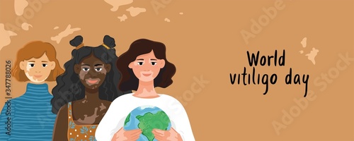 Three happy women of different nationalities hold a globe. Banner concept of the world vitiligo day. Template for a poster, postcard about people with autoimmune skin disease. Vector illustration.