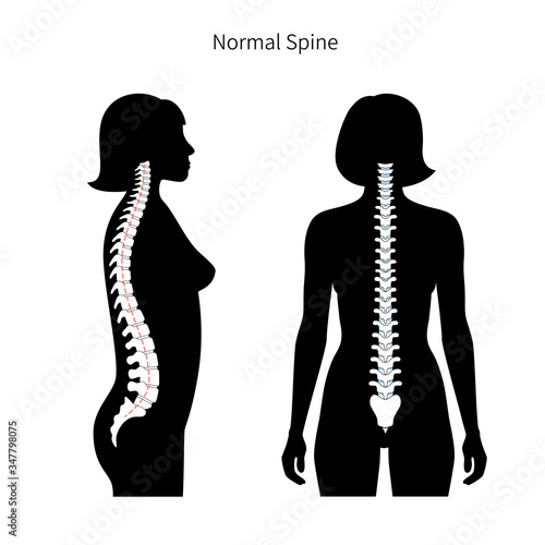 Woman healthy spine vector illustration