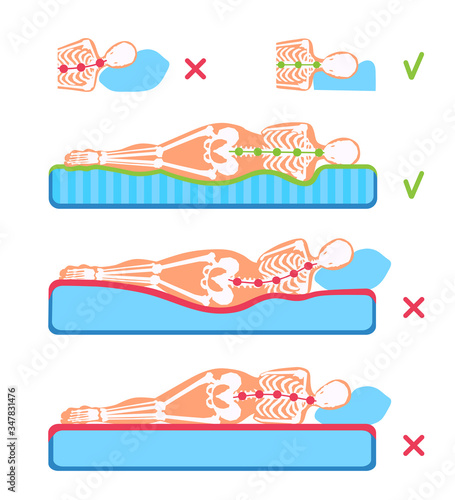 A woman lying on her side on the orthopedic mattress and pillow. A human body silhouette with a skeleton. Good and bad posture, position. Spine and head support. A comparison illustration.