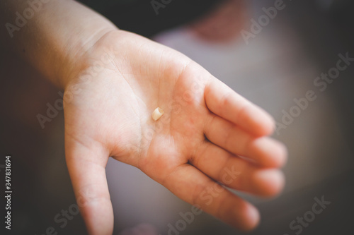 Close up image of a young girl loosing a tooth