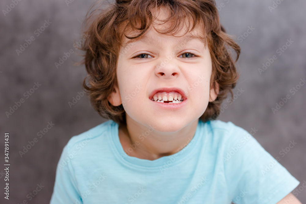 Charming curly boy smiles without tooth on white background. The boy lost the first milk tooth. Healthy teeth concept, dental clinic. Charming curly boy smiles without tooth on white background. The boy lost the first milk tooth. Healthy teeth concept, dental clinic.