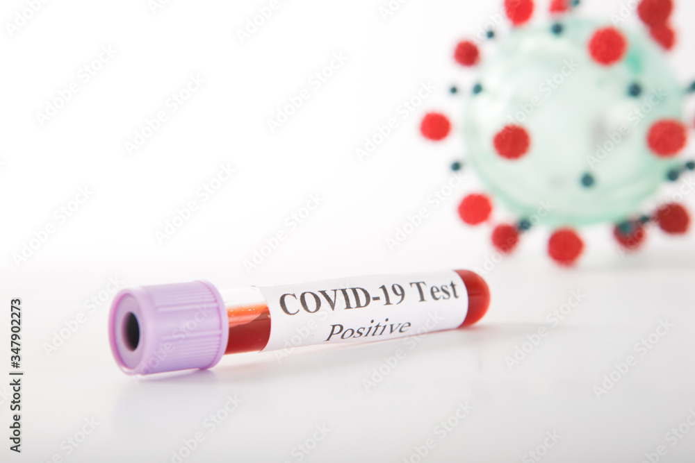 Test tube with a positive COVID-19 test on a white background Test tube with a positive COVID-19 test on a white background